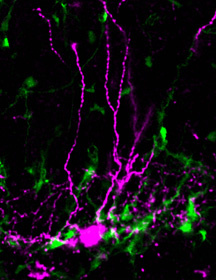 单个帕瓦耳蛋白 - 表达的interneuron