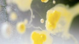 粪便标本细菌培养