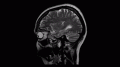 脑扫描