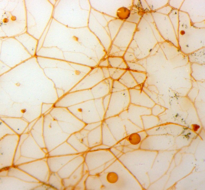 AM真菌菌丝的彩色显微镜照片