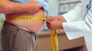 医生测量腰部肥胖男人