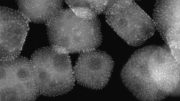 铂纳米粒子的电子显微照片