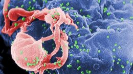 HIV图像