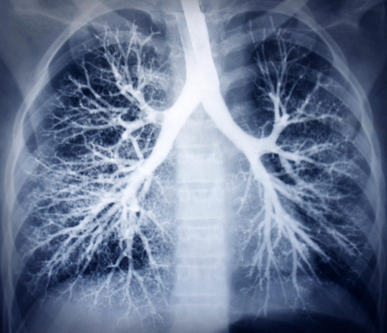 健康的肺扫描