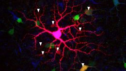 本质光敏视网膜神经节细胞