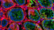 麻省理工学院的研究人员开发了一种新的模型来加速结肠癌的研究