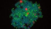 神经母细胞瘤细胞DNA