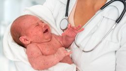 新生儿与麻疹