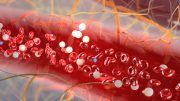 新开发的微流体装置将血浆细胞与血液分离