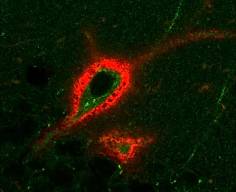 周神经网络小鼠大脑