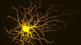 视网膜神经节细胞