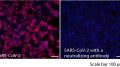 SARS-CoV-2感染的Vero细胞