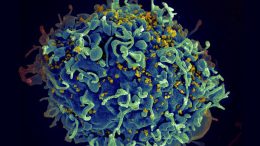 T细胞HIV病毒