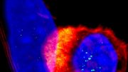 T细胞靶向肿瘤细胞