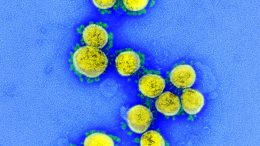 SARS-CoV-2病毒颗粒的透射电镜照片