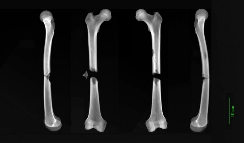 Friar股骨骨折的X射线