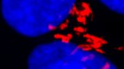 位于人胚胎干细胞的Golgi的活性吠饼（红色）