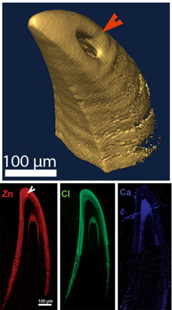 牙尖的微电脑断层图像