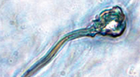 精子显微镜 - 图像